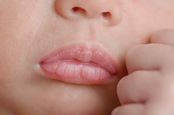 Trẻ sơ sinh khô môi là dấu hiệu trẻ bị thiếu nước