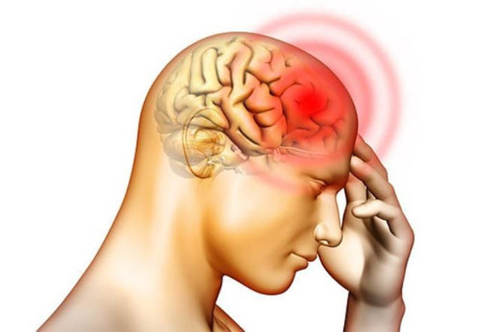 Bệnh thiếu máu não