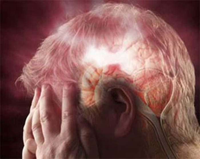 Triệu chứng bệnh thiếu máu não