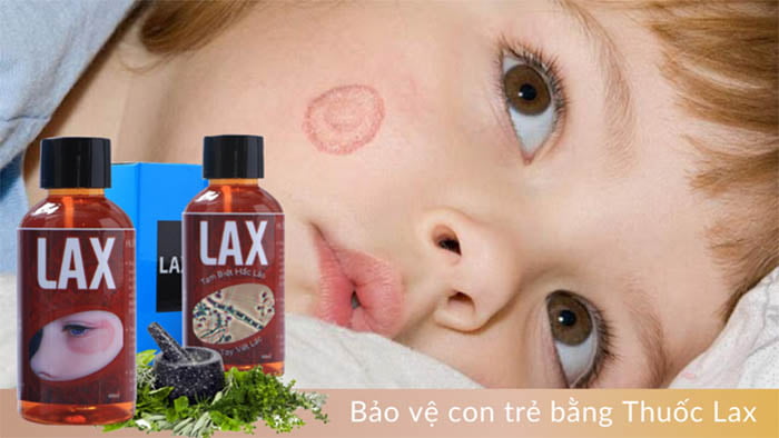 Thuốc Lax trị hắc lào